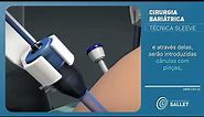 Técnica Sleeve | Cirurgia Bariátrica 3D