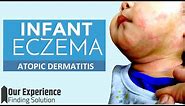 How to treat Infant Atopic Dermatitis (Eczema) | We found the Best Treatment for our Baby