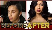 CARDI B | BEFORE & AFTER TRANSFORMATION ( Plastic Surgery )