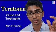 Teratoma: Cause and Treatment