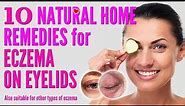 10 Best Natural Home Remedies for Eczema on Eyelids | how to treat eczema eyelids 2021