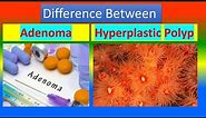 Difference between Adenoma and Hyperplastic polyp