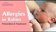 Common Allergies in Babies and How to Handle Them