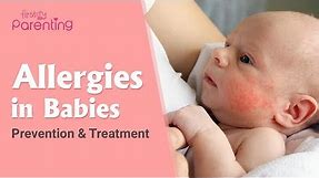 Common Allergies in Babies and How to Handle Them