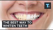 The best way to whiten teeth
