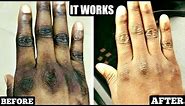 HOW TO GET RID OF DARK KNUCKLES NATURALLY IN 3 DAYS | It Really Works