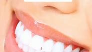 Reply to @zainsupbish Vampire teeth! #dentist #vampireteeth #fangs #veneers #teethfile intro vid: @ivanapetrowa bg img: yt dr Stuart frost, mr dentist