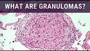 What are Granulomas? - Pathology mini tutorial