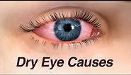 Dry Eye Causes and Treatment