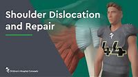 Shoulder Dislocation and Repair