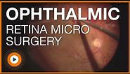 Ophthalmic Microscope Surgery Posterior Retina