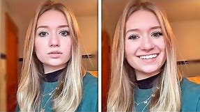 Teenager Can 'Delay' Her Voice
