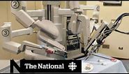 Robot-assisted surgery brings precision, problems