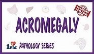 Acromegaly - Pathophysiology, Symptoms, Diagnosis, Treatment