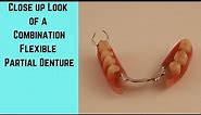 Flexible Partial Denture, a close look at a combination flexible partial denture.