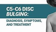 C5-C6 Disc Bulging: Diagnosis, Symptoms, and Treatment