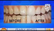 Zoom professional in chair teeth whitening on Today EXTRA | Philips | Dental Professionals