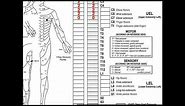 Classifying Spinal Cord Injuries using ASIA Scoring [Explanation + Example 1]