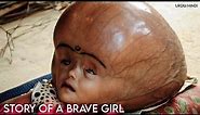 Why This Indian Girl has a Big Head ? ‎हिन्दी
