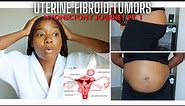 Massive Fibroid Tumors Journey | My Symptoms, Diagnosis, and Pre-Op Myomectomy/C-Section