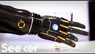 Engineers Created A New Bionic Arm That Can Grow With You