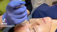 Virtue RF is the newest generation of radio frequency microneedling. This minimally-invasive treatment helps stimulate natural collagen production. You will notice tighter skin, improved tone and texture as well as smaller pore size. Offering a truly comfortable patient experience, the Virtue RF treatment is unmatched in comfort and results. Call today 📞 to schedule your consultation 386-677-9044. #virtuerf #virtuerfmicroneedling #nonsurgicalrejuvenation #aesthetics #portorange #ormondbeach #ne