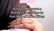 Lesson 23: How to Remove a Hickey Fast: Tips to Get Rid of Love Bites 💋 #DearCupidChallenge #LauvetteSelfLoveClub #LearnAtLauvette #lauvetteph #lauvette🥰🥰😘😘 #femmes #femily #foryou #positivity #gogirl #fypシ゚viral #seggseducation #lovebites #tipsandtricks