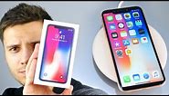 NEW iPhone X Clone Unboxing!