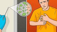 13 Symptoms of Mold Illness Everyone Needs to Know