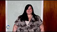 Watch Skin Removal Surgery for Woman that Lost 280 Pounds
