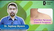 Black Warts on Face & Back|Removal of SEBORRHEIC KERATOSIS #skin -Dr.Rajdeep Mysore|Doctors' Circle