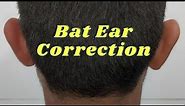 Bat Ear treatment| Correction of prominent ear| Surgery of bat Ear