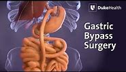 Gastric Bypass Surgery | Duke Health
