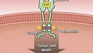 Osimertinib in Advanced Non–Small-Cell Lung Cancer