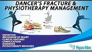 DANCER'S FRACTURE & PHYSIOTHERAPY MANAGEMENT