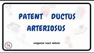 PATENT DUCTUS ARTERIOSUS | Causes | Symptoms | Pathophysiology | Treatment | The Nurses Station