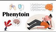 Phenytoin - Uses, Mechanism Of Action, Adverse Effects & Toxicity (Anti-epileptic Drugs)