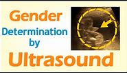 Gender Determination by Ultrasound
