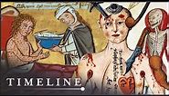 The Most Gruesome Diseases Of The Middle Ages | Medieval Dead | Timeline