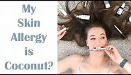 How I Found Out I'm Allergic to Coconut - Coconut Skin Allergy
