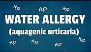 Water Allergy: 10 Interesting Facts About Aquagenic Urticaria