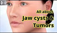 Jaw Cysts & Tumors Diagnosis & Treatment - Dr. Girish Rao