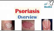 Overview of Psoriasis | What Causes It? What Makes It Worse? | Subtypes and Treatment