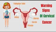 Early Warning Signs Of Cervical Cancer You Must Know - Cervical Cancer Symptoms