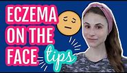 Eczema on the face: 11 tips from a dermatologist| Dr Dray