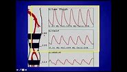 How to Perform and Interpret Peripheral Arterial Doppler Examinations