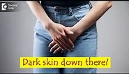 Dark skin of private parts in women. Causes & How to lighten it? - Dr. Regina Joseph|Doctors' Circle