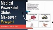 Medical PowerPoint Slides Makeover (Example 1)