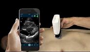 How to use Clarius for a FAST Exam | Clarius Portable Handheld Ultrasound
