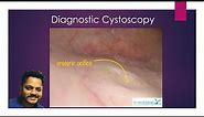 #17: Diagnostic Cystoscopy (Voiceover): SEE WHAT A BLADDER LOOKS LIKE FROM THE INSIDE!